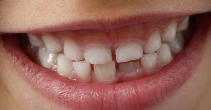 stencil.facebook-linked-image (18) dental program